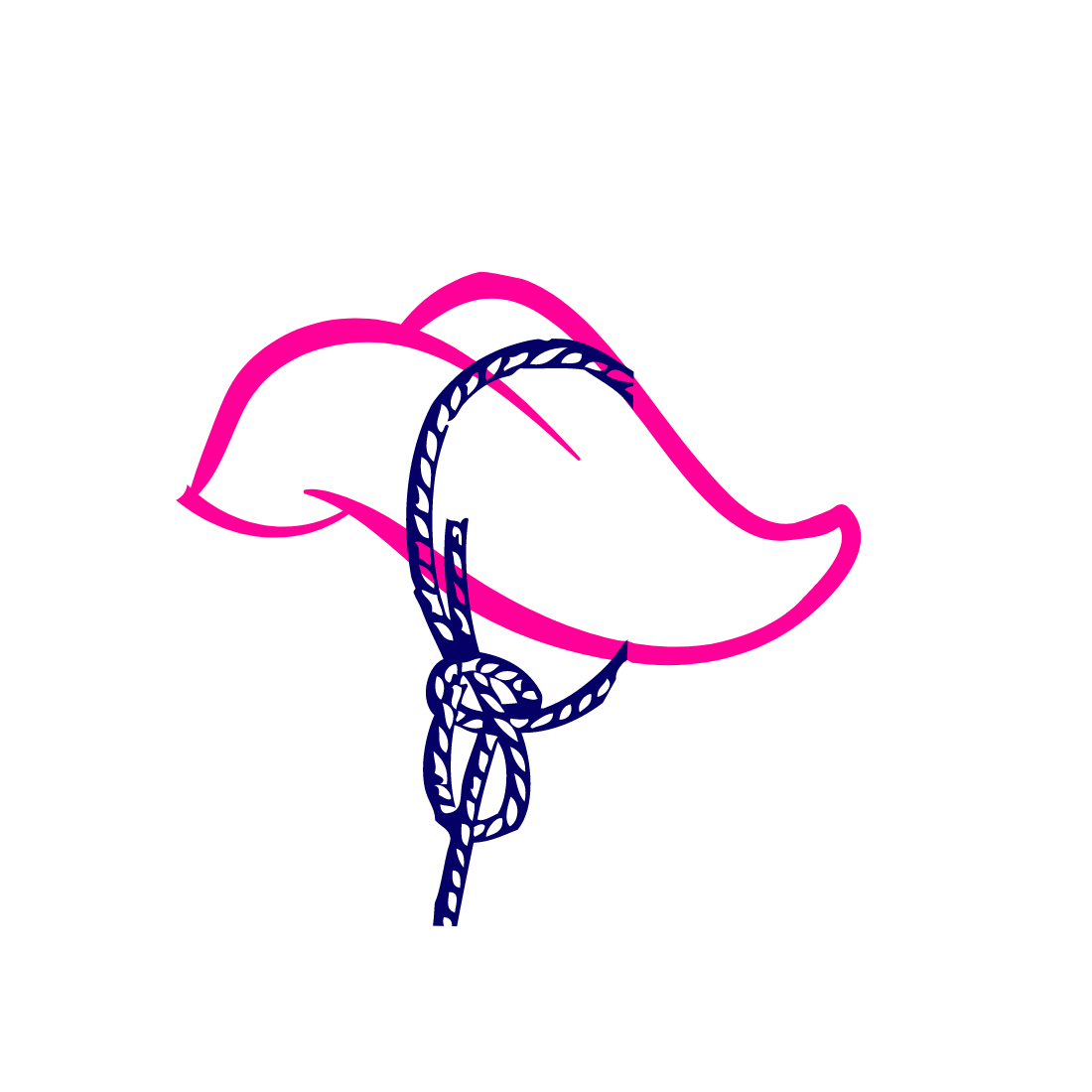 Illustration explaining posterior tongue ties